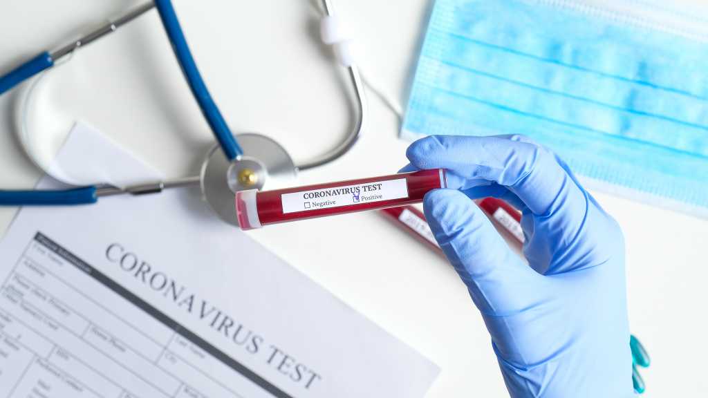 179 Hoax Terkait Virus Corona Covid-19 Beredar di Dunia Maya 179 Hoax Terkait Virus Corona Covid-19 Beredar di Dunia Maya