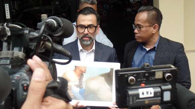 Penangguhan Penahanan Axel Ditolak, Jeremy Thomas Pasrah Penangguhan Penahanan Axel Ditolak, Jeremy Thomas Pasrah