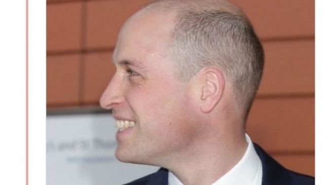 Pangeran William Potong Rambut, Apa Kata Pakar? Pangeran William Potong Rambut, Apa Kata Pakar?