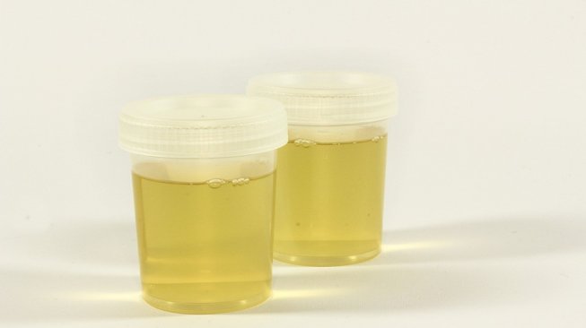 Oknum Guru Buat Murid-murid SD Minum Urinenya, Apa Dampaknya? Oknum Guru Buat Murid-murid SD Minum Urinenya, Apa Dampaknya?
