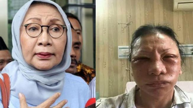 Jangan Berbohong Kayak Ratna Sarumpaet, Ini Efeknya ke Kesehatan Jangan Berbohong Kayak Ratna Sarumpaet, Ini Efeknya ke Kesehatan