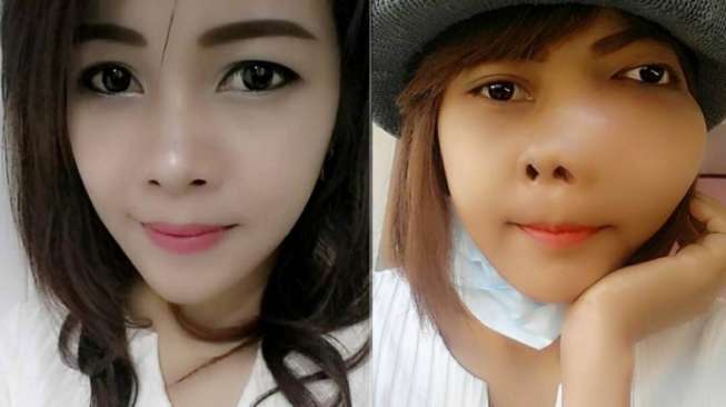 Dikira Sakit Gigi, Perempuan Ini Meninggal Idap Kanker Tulang Dikira Sakit Gigi, Perempuan Ini Meninggal Idap Kanker Tulang