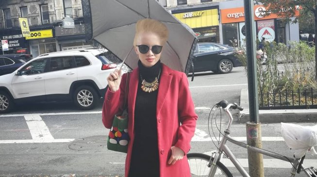 Thando Hopa, Wanita Albino Pertama di Cover Majalah Vogue Thando Hopa, Wanita Albino Pertama di Cover Majalah Vogue