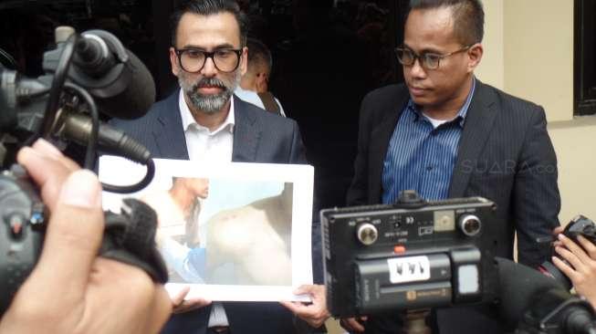 Pengacara Sebut Lelaki Ini yang Tawari Axel Thomas Narkoba Pengacara Sebut Lelaki Ini yang Tawari Axel Thomas Narkoba