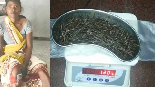 Dokter Kebingungan karena Perempuan Ini Keluarkan Jarum dari Kaki Dokter Kebingungan karena Perempuan Ini Keluarkan Jarum dari Kaki