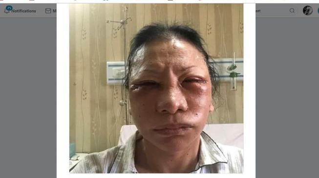 Ratna Sarumpaet Ngaku Berbohong, Begini Reaksi Para Artis Ratna Sarumpaet Ngaku Berbohong, Begini Reaksi Para Artis
