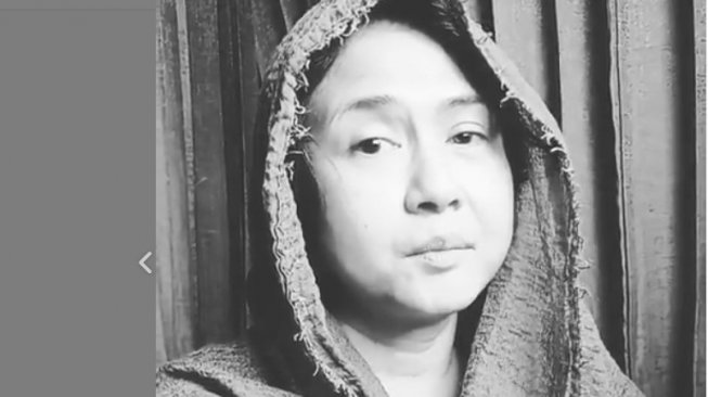 Ria Irawan Jalani Radioterapi Angkat Tumor di Kepala selama Sepekan Ria Irawan Jalani Radioterapi Angkat Tumor di Kepala selama Sepekan