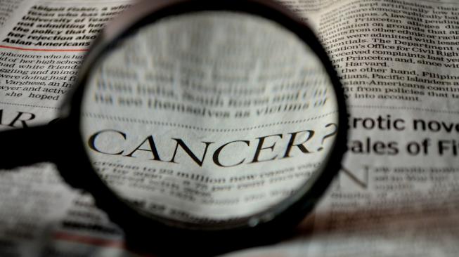 Dari Kanker Paru hingga Prostat, Berikut 5 Kanker Paling Memakan Korban