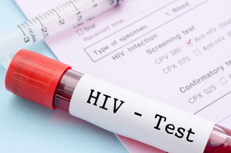 Tak Selalu Lewat Seks, HIV Juga Bisa Menular Lewat Hal-hal Tak Terduga Berikut Tak Selalu Lewat Seks, HIV Juga Bisa Menular Lewat Hal-hal Tak Terduga Berikut