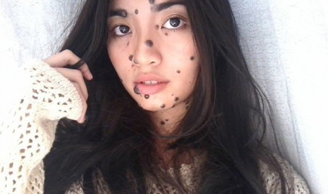 Akankah Wanita Dipenuhi Tahi Lalat Ini Jadi Miss Universe? Akankah Wanita Dipenuhi Tahi Lalat Ini Jadi Miss Universe?