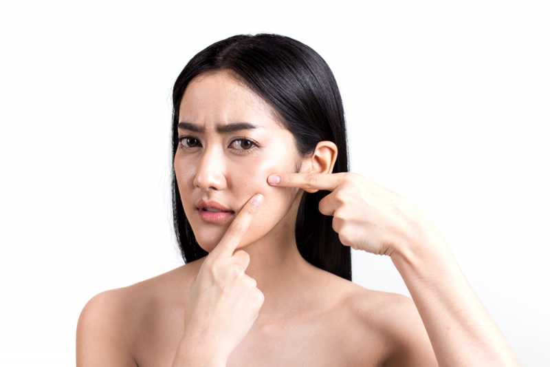 Ciri-Ciri Jerawat Anda Sudah Terinfeksi, Plus Cara Mengatasinya Ciri-Ciri Jerawat Anda Sudah Terinfeksi, Plus Cara Mengatasinya