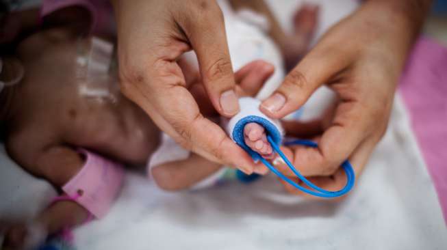 Saybie, Bayi Terkecil di Dunia yang Beratnya Cuma 245 Gram Saybie, Bayi Terkecil di Dunia yang Beratnya Cuma 245 Gram