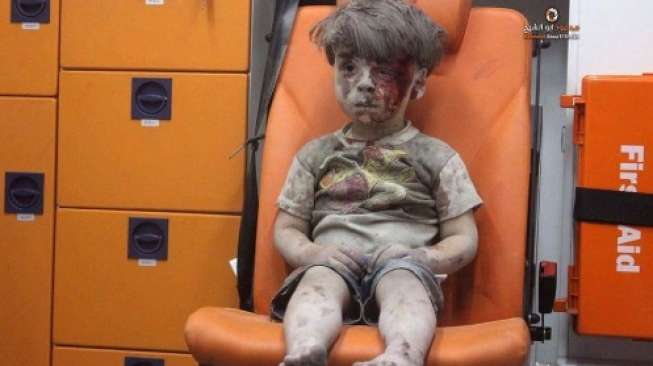 Ingat Bocah Suriah yang Berlumur Darah? Inilah Dia Kini