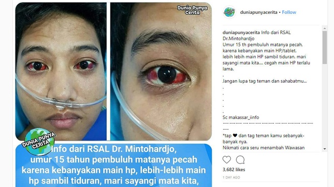 Pembuluh Darah Matanya Pecah karena Main Ponsel?