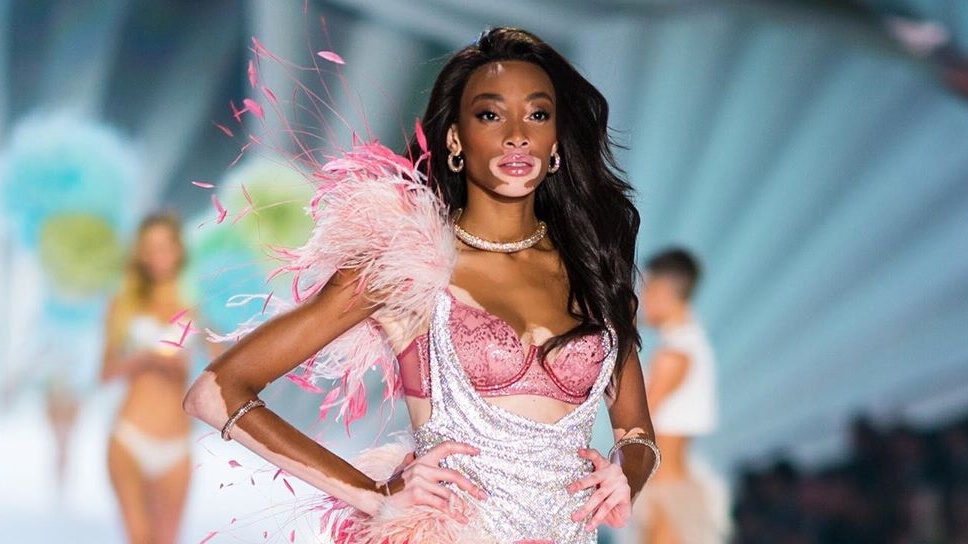 Winnie Harlow, Model Vitiligo Pertama di Show Victorias Secret