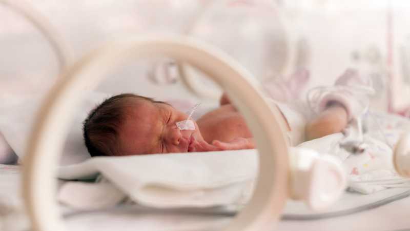 Berapa Lama Bayi Prematur Harus Berada di Inkubator?