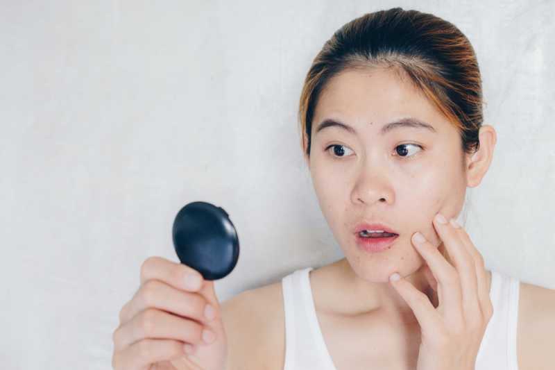 8 Cara Alami Bebaskan Muka dari Komedo Hitam yang Membandel 8 Cara Alami Bebaskan Muka dari Komedo Hitam yang Membandel