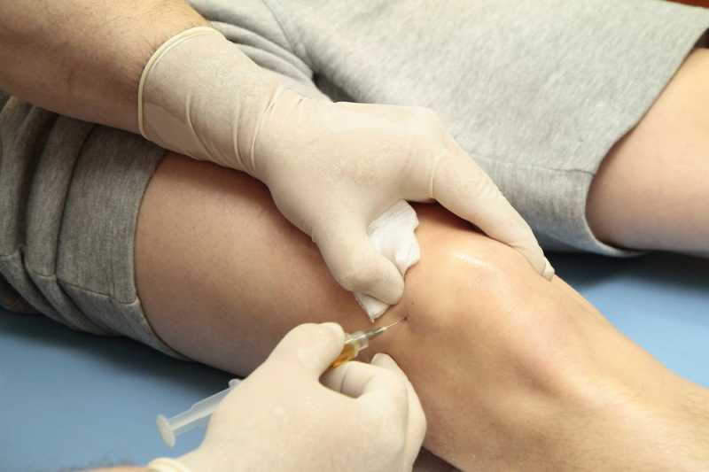 Pro dan Kontra Mengobati Osteoarthritis dengan Suntik Lutut Pro dan Kontra Mengobati Osteoarthritis dengan Suntik Lutut